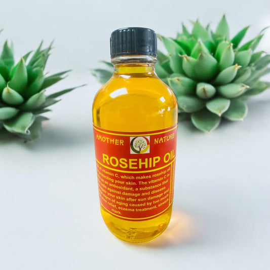Rosehip Oil (2 oz Size) -(6 pieces) @ $5.99/each